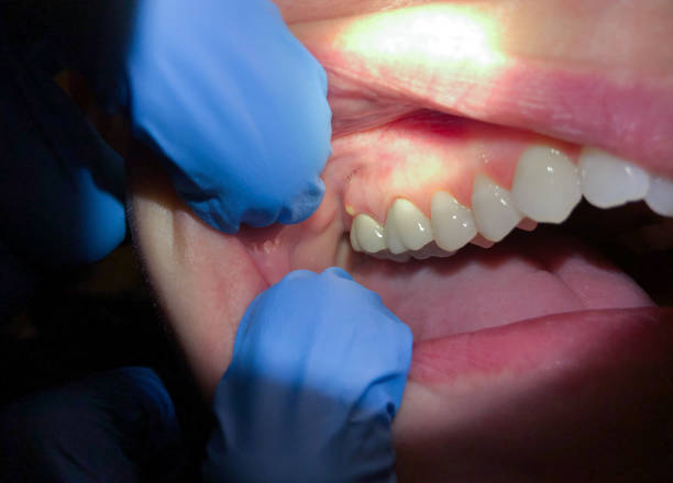 Best Weekend Emergency Dentist in Mount Vernon, KY