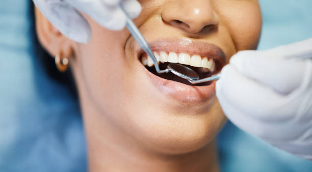 Best Emergency Dental Care for Broken or Chipped Teeth in Mount Vernon, KY